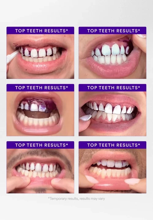 Dambodas™ Purple Teeth Whitening Strips