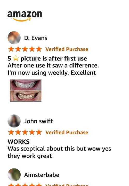Dambodas™ Purple Teeth Whitening Strips